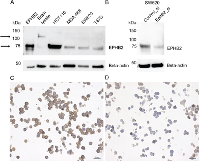 EPHB2 Antibody validation by immunoblot and immunocytochemistry.