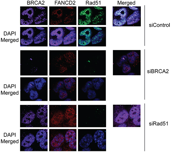 Downregulation of Rad51 or BRCA2 does not significantly effect on CPT-induced foci formation of Rad18 and FANCD2.