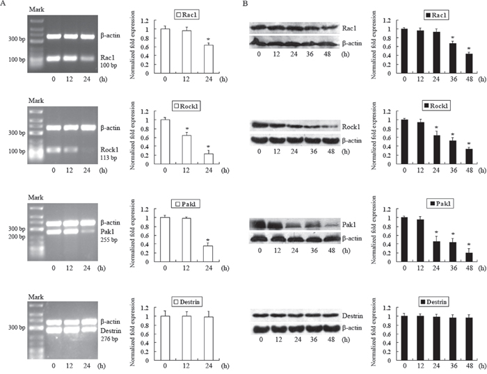 Analysis of the effects of DADS on Rac1, Rock1, Pak1 and destrin expression in MGC803 cells.