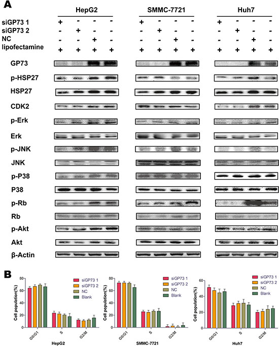 GP73 silencing downregulated p-Rb but did not impact cell cycle progression.