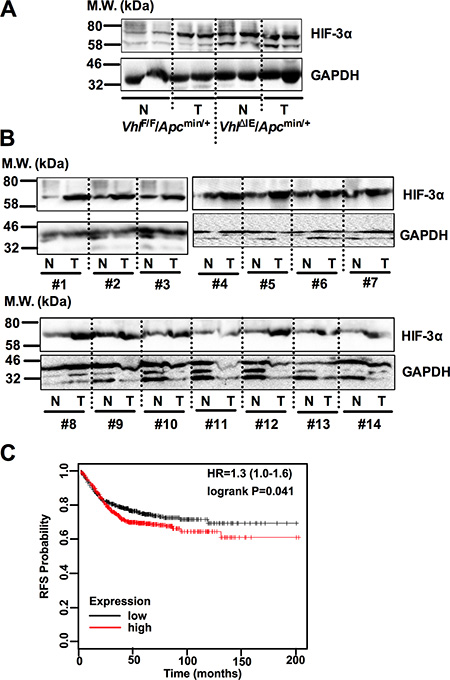 HIF-3&#x03B1; is overexpressed in CRC.