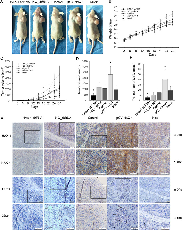 Constitutive silencing and activation of HAX-1 on growth of NPC in nude mice.