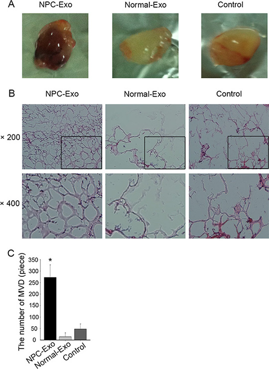 In vivo proangiogenic effects of NPC-exosomes.