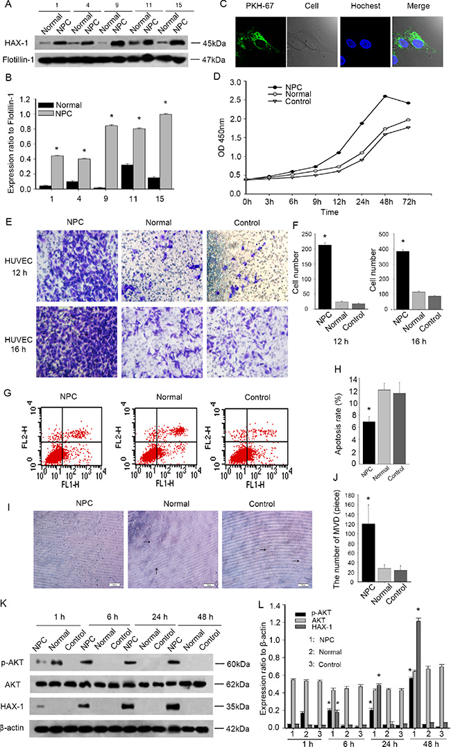 NPC-exosomes are enriched in HAX-1 which increases proliferation, migration and angiogenesis in HUVECs.