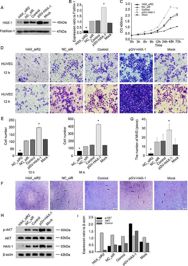 Transfer of exosomal HAX-1 increases proliferation, migration and angiogenesis effects in HUVECs.