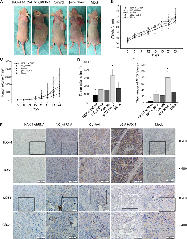 Exosomal HAX-1 accelerate NPC xenograft tumors growth and angiogenesis.