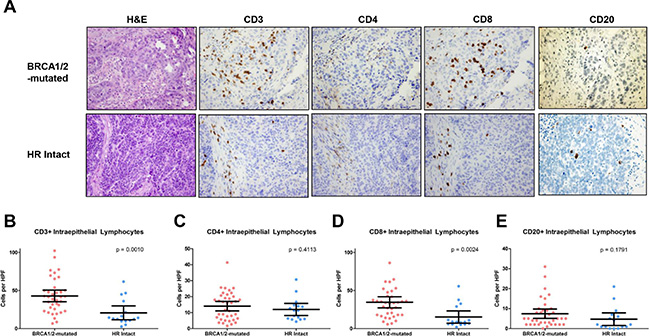 CD3+, CD4+ CD8+ and CD20+ intraepithelial lymphocytes in BRCA1/2-mutated vs HR proficient tumors.