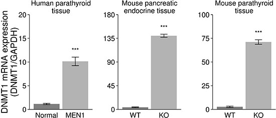 Increased expression of DNMT1 in the endocrine tumor tissues from human MEN1 parathyroids and Men1 KO mice.