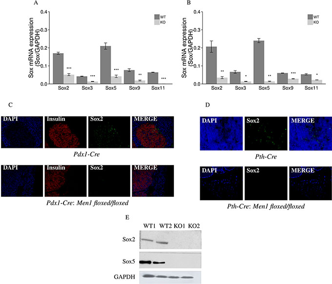 Aberrant methylation and expression of Sox genes in endocrine tumors from Men1 KO mice.