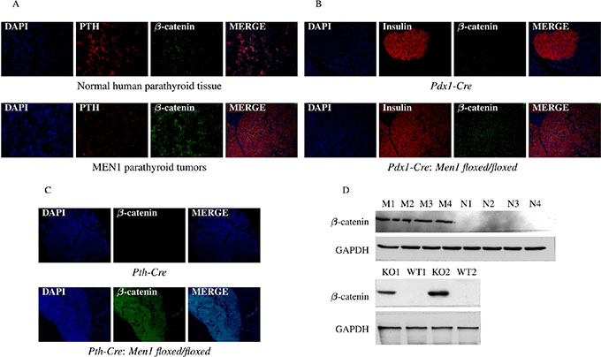 Hypermethylation of Sox genes results in increased &beta;-catenin expression.