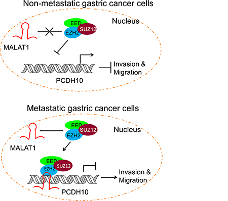 Schematic representation of the consequence of EZH2-MALAT1 interaction on the gastric cancer migration and invasion.
