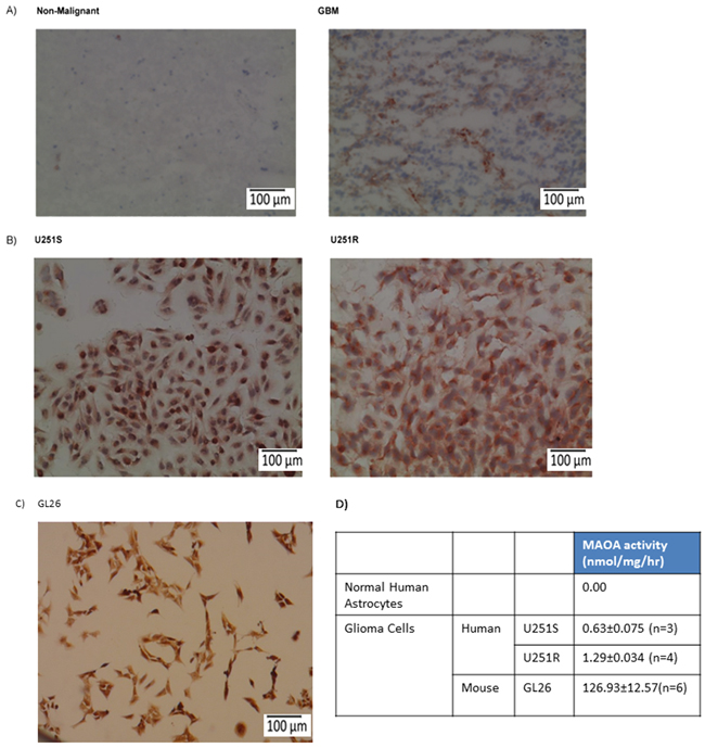 MAO A expression and activity are increased in mouse and human glioma cell lines and glioma tissues.