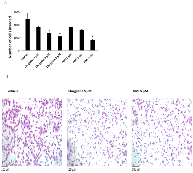 The effects of clorgyline and NMI on the invasive capacity of glioma cells.