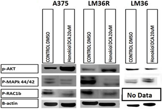 Western blot analysis show increased levels of p-AKT S473 on human melanoma cell lines A375 and vemurafenib resistant LM36R when treated for 24hrs at 20 &#x03BC;M.