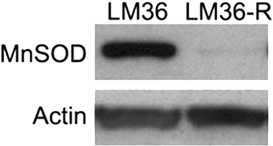 Western blot analysis comparing LM36 and LM36R MnSOD levels shows a loss of MnSOD expression in LM36R when compared to its parental cell line LM36.