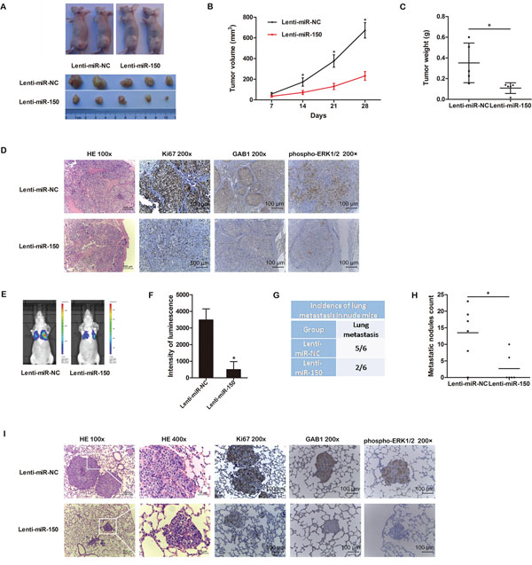 miR-150 suppresses tumor growth and metastasis in vivo.