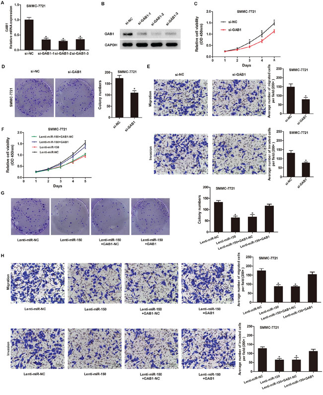 miR-150 inhibits HCC cell proliferation, migration and invasion by targeting GAB1.