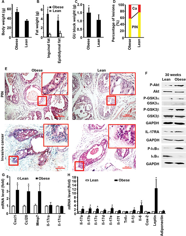 High-fat diet-induced obesity promotes prostate cancer formation in Pten conditional knockout mouse prostates.