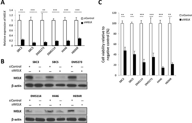 siRNA-mediated MELK knockdown results in decrease of cell viability in SCLC cells.