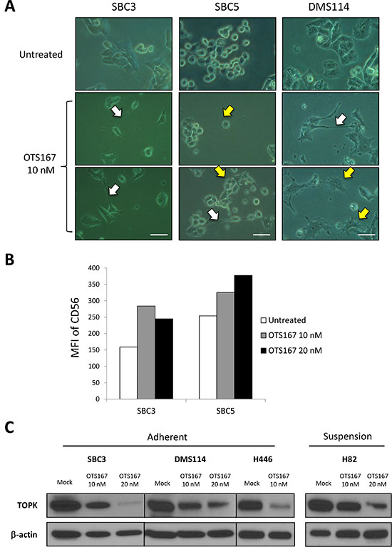MELK inhibitor induces cytokinetic defects accompanied with differentiation into neuron-like cells.