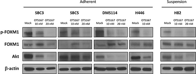 Treatment with MELK inhibitor downregulates FOXM1 activity and Akt expression in SCLC cells.