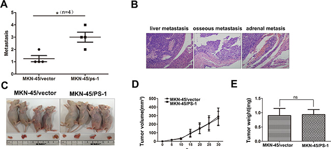 PS-1 enhances the colonization of MKN-45 cells, but not proliferation in vivo.