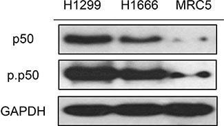 p50 and phosphorylated p50 (Ser337) are overexpressed in NSCLC cell lines H1299 and H1666.