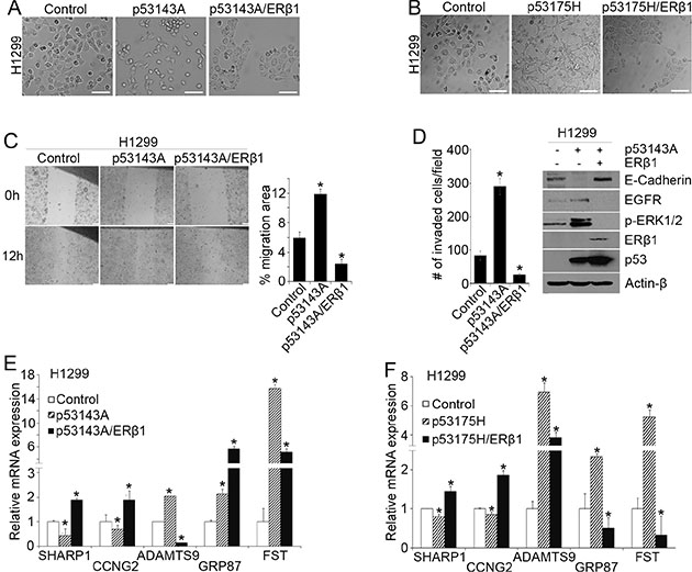ER&#x03B2;1 decreases cell invasion by regulating mutant p53 target genes.