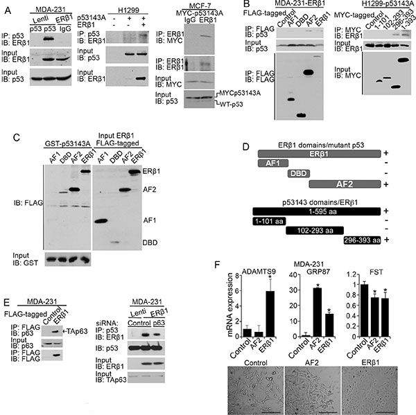 ER&#x03B2;1 interacts with mutant p53 and p63.