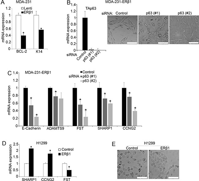 p63 affects the regulation of mutant p53 by ER&#x03B2;1.