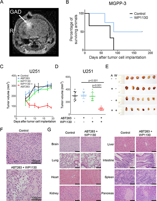 Intracranial convection-enhanced delivery of WP1130 prolongs survival and combined treatment with ABT263 and WP1130 results in an enhanced inhibition of tumor growth in vivo.