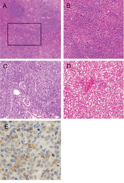 Histopathological abnormality of TSC-22 transgenic mice.