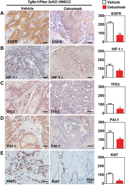 Targeting hypoxia by cetuximab decrease TFE3 in Tgfbr1/Pten 2cKO mice.