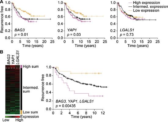 Expression of BAG3, YAP1 and galectin-1 is associated with poor prognosis.