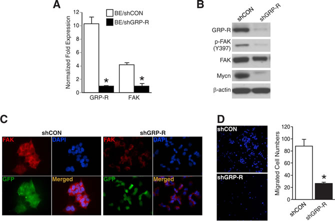 GRP-R silencing decreased FAK and cell migration in BE(2)-C cells.