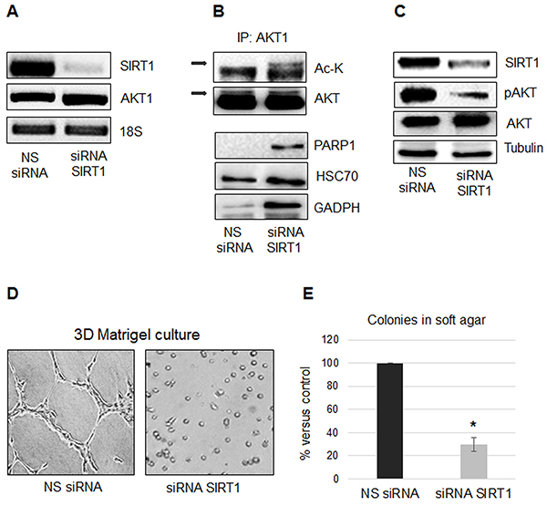 SIRT1 regulates AKT1 acetylation and protein interactions.
