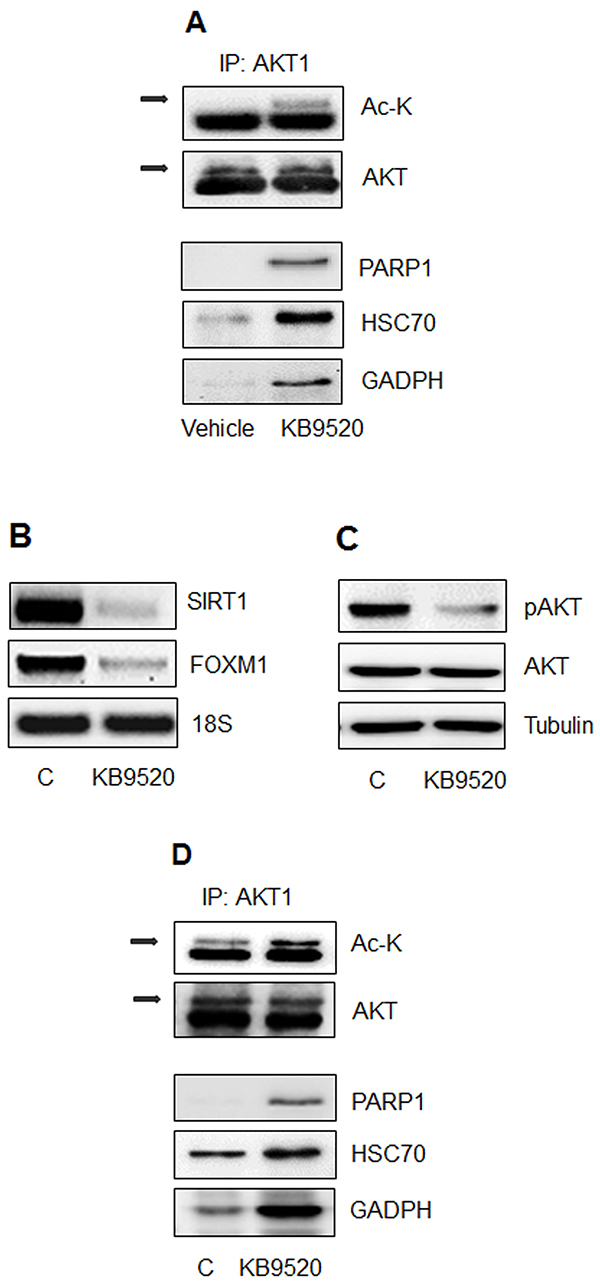 The ER&#x03B2; selective agonist KB9520 promotes AKT acetylation and protein interaction in vitro and in vivo.