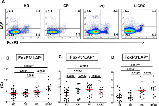 Comparisons between healthy donors and patients for the expression of LAP on activated FoxP3+/&#x2013; T cell subsets.