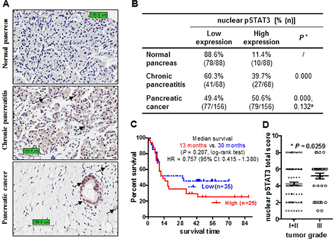 Increased nuclear pSTAT3 expression in human pancreatic adenocarcinoma is associated with poor clinical outcome.