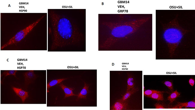 The sub-cellular distribution and morphology of chaperone complexes in cells before and after treatment with [OSU-03012 + sildenafil], Part 1.
