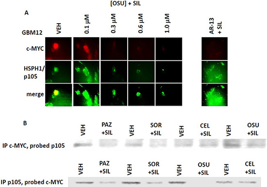 Figure 12. Co-localization of the NH2-terminal and COOH-terminal directed HSP70 antibodies.