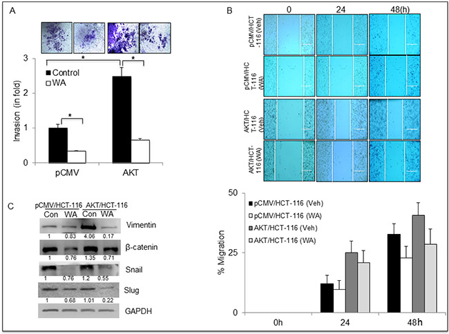 WA inhibits EMT in HCT-116 stable transfectants.