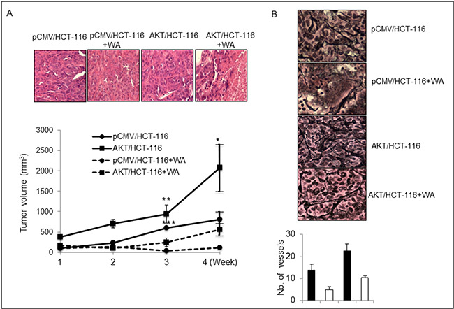 WA inhibits in vivo tumor growth.