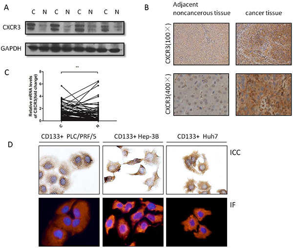 CXCR3 is upregulated in HCC tissues and also expressed in CD133+ liver cancer cells.