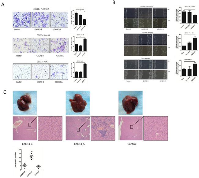 CXCR3-A enhances invasion and migration of CD133+ liver cancer cells in vitro, and promotes hepatic metastasis in vivo.