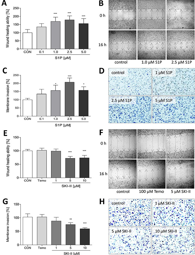 Influence of S1P, temozolomide and SKI-II on migration of LN18 GBM cells.