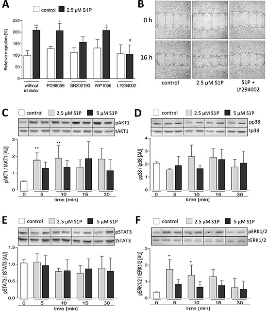 Association between signaling pathways and S1P induced migration of LN18 GBM cells.