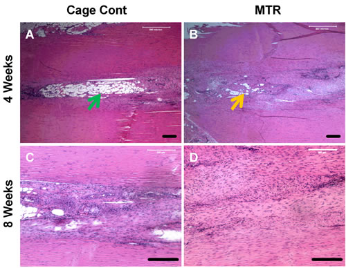 Histological analysis of wound healing in aging rat patellar tendons.