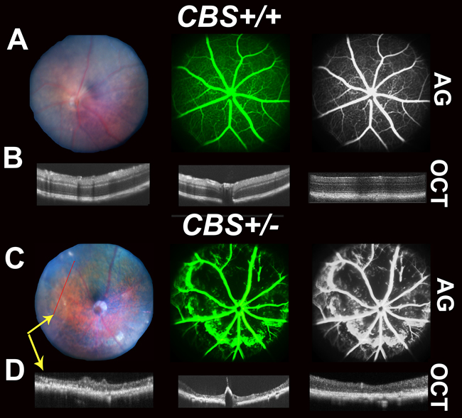 Retinal Fundus examination, Fluorescein angiogram (FA) and Optical Coherence Tomography (OCT) assessment of 64-week