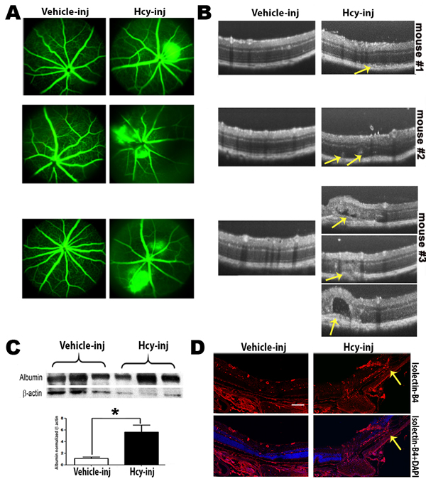 Evaluation of Retinas of C57BL6 mice injected intravitreally with Hcy-thiolactone.